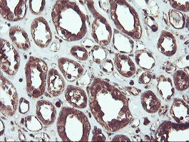 m04491 anti serpinb1 mouse monoclonal antibody clone id oti4b3 ihc testing 8