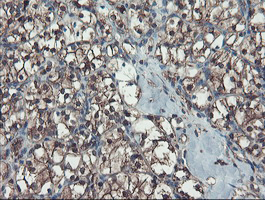 m04491 anti serpinb1 mouse monoclonal antibody clone id oti4b3 ihc testing 9