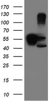 HEK293T cells were transfected with the pCMV6-ENTRY control (Left lane) or pCMV6-ENTRY SERPINB1 (Right lane) cDNA for 48 hrs and lysed