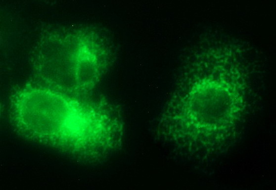 Anti-VEGFB mouse monoclonal antibody (M04494) immunofluorescent staining of COS7 cells transiently transfected by pCMV6-ENTRY VEGFB