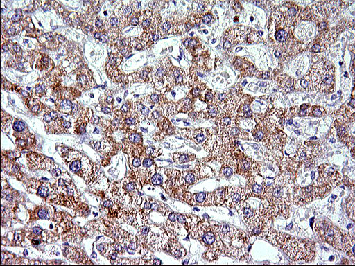 Immunohistochemical staining of paraffin-embedded Human liver tissue within the normal limits using anti-VEGFB mouse monoclonal antibody