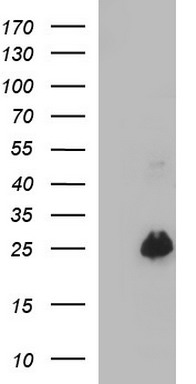 HEK293T cells were transfected with the pCMV6-ENTRY control (Left lane) or pCMV6-ENTRY VEGFB (Right lane) cDNA for 48 hrs and lysed