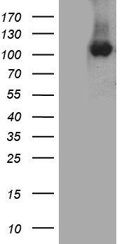 HEK293T cells were transfected with the pCMV6-ENTRY control (Left lane) or pCMV6-ENTRY CSE1L (Right lane) cDNA for 48 hrs and lysed