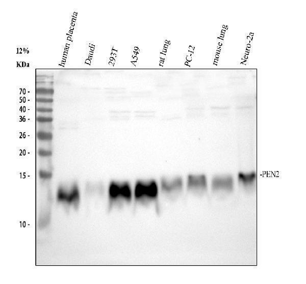Western blot analysis of PEN2 using anti-PEN2 antibody (M04504-1)