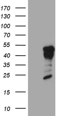 HEK293T cells were transfected with the pCMV6-ENTRY control (Left lane) or pCMV6-ENTRY GCM1 (Right lane) cDNA for 48 hrs and lysed