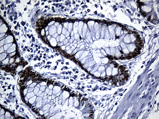 m04522 anti cdx1 mouse monoclonal antibody clone id oti2a5 ihc testing 2