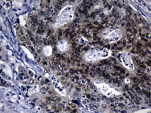 m04522 anti cdx1 mouse monoclonal antibody clone id oti2a5 ihc testing 3