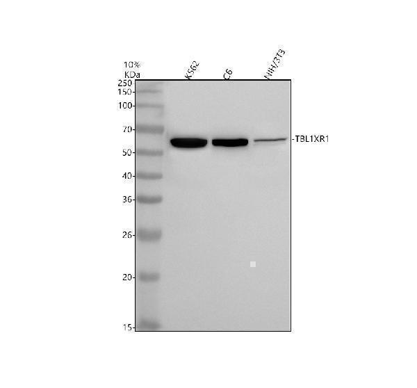 Western blot analysis of TBLR1 using anti-TBLR1 antibody (M04524)