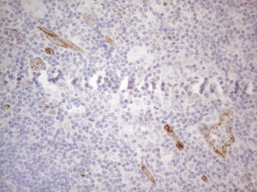 m04530 anti gemin 2 gemin2 mouse monoclonal antibody clone id oti4c11 ihc testing 2