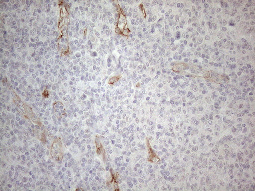 m04530 anti gemin 2 gemin2 mouse monoclonal antibody clone id oti4c11 ihc testing 3