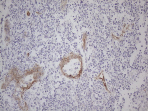 m04530 anti gemin 2 gemin2 mouse monoclonal antibody clone id oti4c11 ihc testing 4