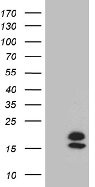 HEK293T cells were transfected with the pCMV6-ENTRY control (Left lane) or pCMV6-ENTRY PIP (Right lane) cDNA for 48 hrs and lysed