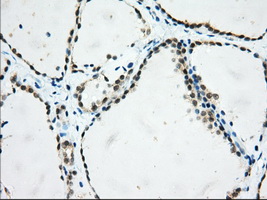 Immunohistochemical staining of paraffin-embedded Human thyroid tissue within the normal limits using anti-USP5 mouse monoclonal antibody