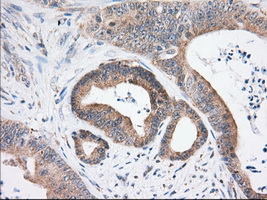 m04550 2 anti usp5 mouse monoclonal antibody clone id oti2f5 ihc testing 5