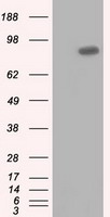HEK293T cells were transfected with the pCMV6-ENTRY control (Left lane) or pCMV6-ENTRY USP5 (Right lane) cDNA for 48 hrs and lysed