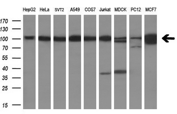 Western blot analysis of extracts (35ug) from 9 different cell lines by using anti-USP5 monoclonal antibody (HepG2: human; HeLa: human; SVT2: mouse; A549: human; COS7: monkey; Jurkat: human; MDCK: canine; PC12: rat; MCF7: human) (1:200)