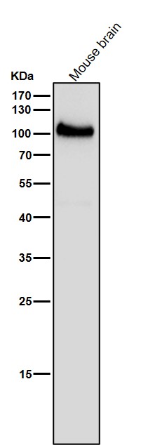 All lanes use the Antibody at 1:1K dilution for 1 hour at room temperature