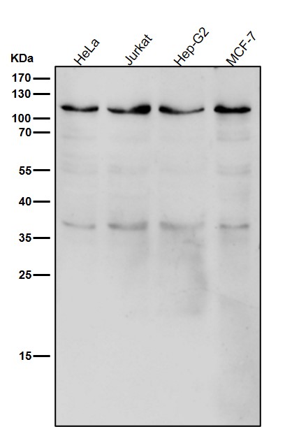 All lanes use the Antibody at 1:1K dilution for 1 hour at room temperature