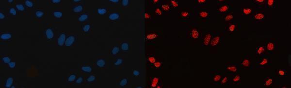 m04551 cpsf6 primary antibodies if testing 9
