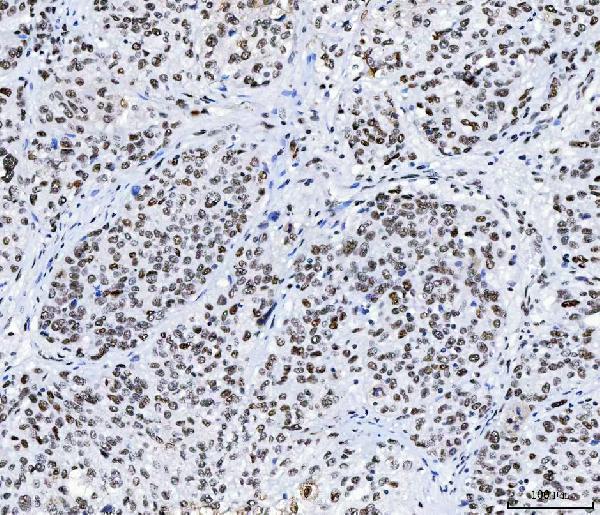  IHC analysis of CPSF6 using anti-CPSF6 antibody (M04551)