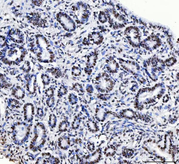  IHC analysis of CPSF6 using anti-CPSF6 antibody (M04551)