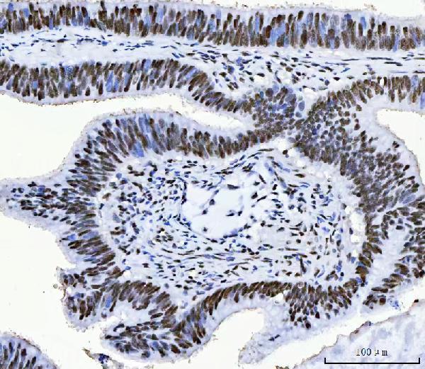 m04551 cpsf6 primary antibodies ihc testing 4
