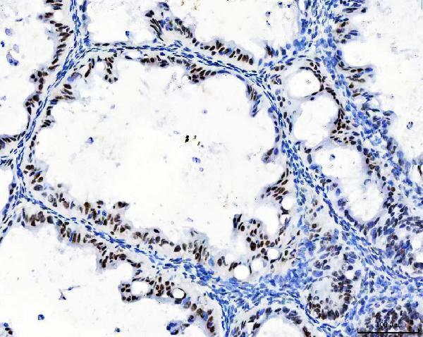 m04551 cpsf6 primary antibodies ihc testing 5