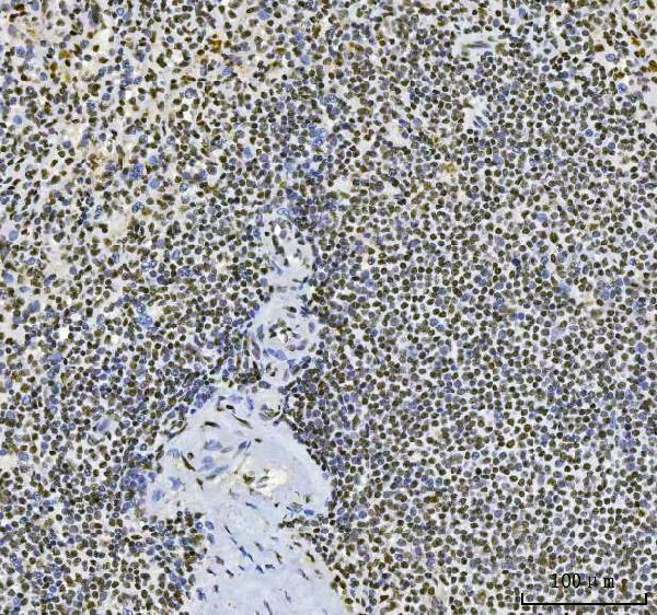 m04551 cpsf6 primary antibodies ihc testing 6