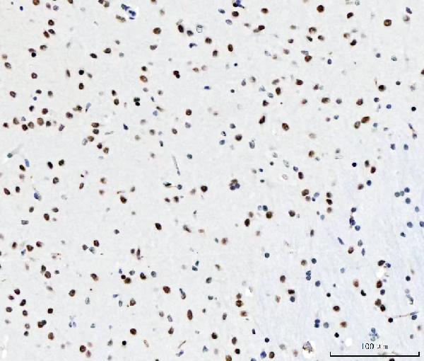m04551 cpsf6 primary antibodies ihc testing 7