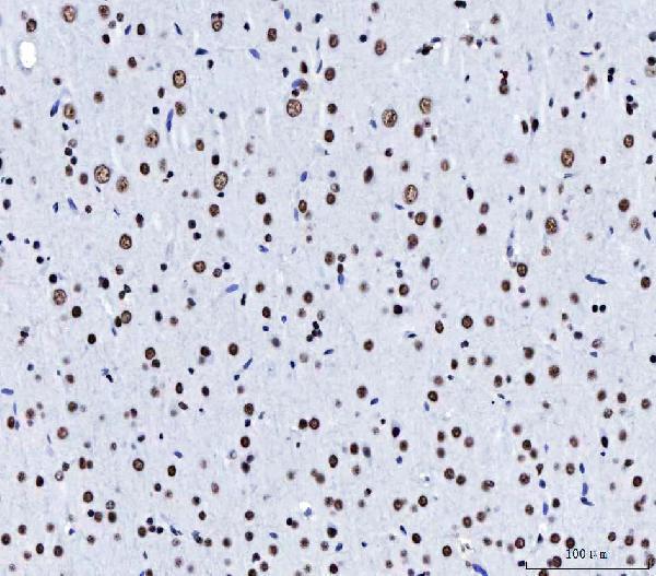 m04551 cpsf6 primary antibodies ihc testing 8