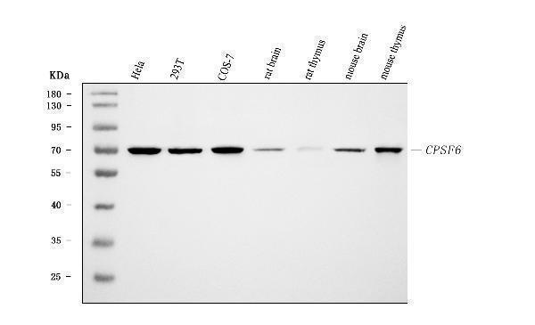  Western blot analysis of CPSF6 using anti-CPSF6 antibody (M04551)
