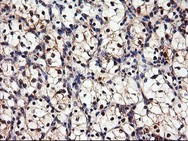 m04552 anti dpp9 mouse monoclonal antibody clone id oti2e3 ihc testing 10