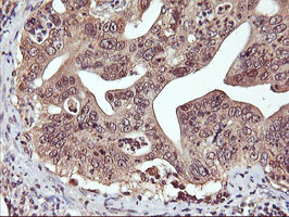 m04552 anti dpp9 mouse monoclonal antibody clone id oti2e3 ihc testing 4
