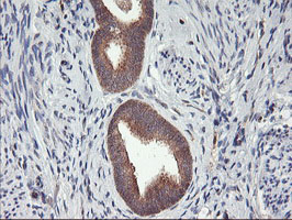 m04552 anti dpp9 mouse monoclonal antibody clone id oti2e3 ihc testing 5