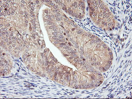m04552 anti dpp9 mouse monoclonal antibody clone id oti2e3 ihc testing 6