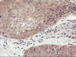 m04552 anti dpp9 mouse monoclonal antibody clone id oti2e3 ihc testing 7