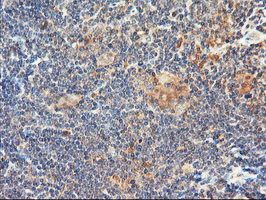 m04552 anti dpp9 mouse monoclonal antibody clone id oti2e3 ihc testing 8