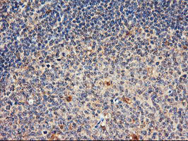 m04552 anti dpp9 mouse monoclonal antibody clone id oti2e3 ihc testing 9
