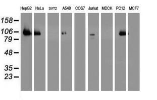 Western blot analysis of extracts (35ug) from 9 different cell lines by using anti-DPP9 monoclonal antibody