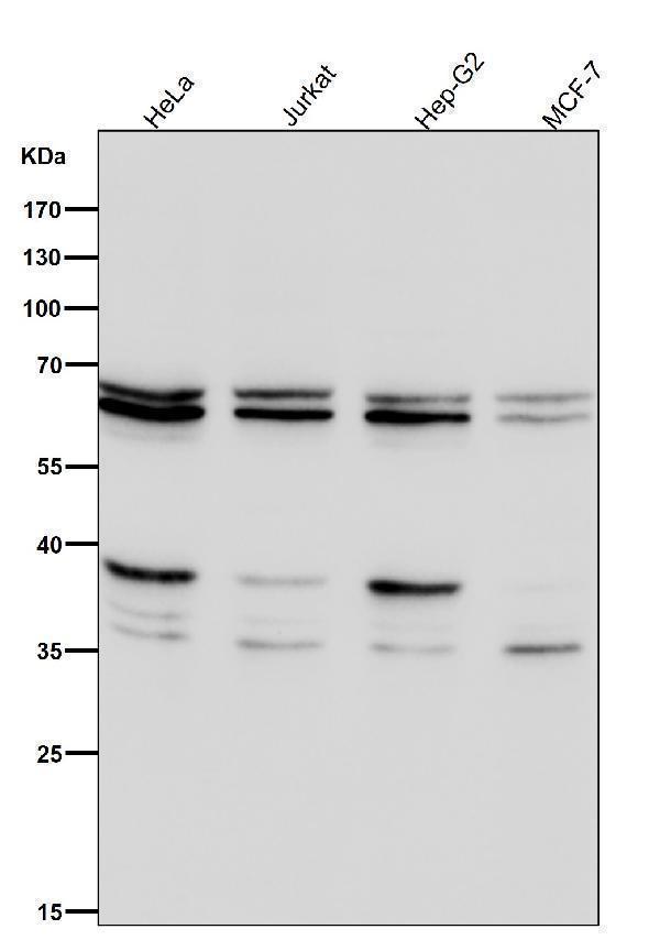 All lanes use the Antibody at 1:2K dilution for 1 hour at room temperature