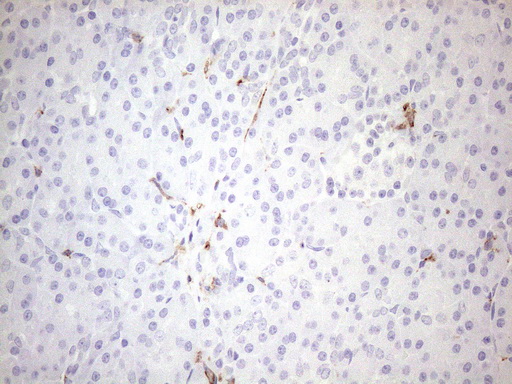 m04574 2 anti folr2 mouse monoclonal antibody clone id oti4g6 ihc testing 2