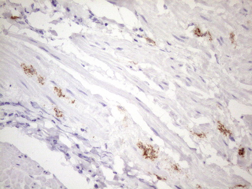 m04574 2 anti folr2 mouse monoclonal antibody clone id oti4g6 ihc testing 3