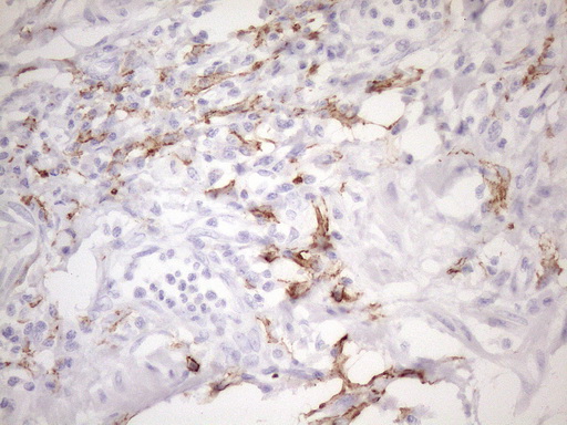 m04574 2 anti folr2 mouse monoclonal antibody clone id oti4g6 ihc testing 4