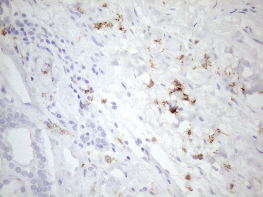 m04574 2 anti folr2 mouse monoclonal antibody clone id oti4g6 ihc testing 5