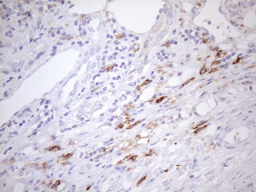 m04574 2 anti folr2 mouse monoclonal antibody clone id oti4g6 ihc testing 6