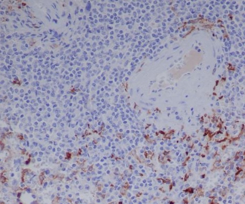 Immunohistochemical analysis of paraffin-embedded human spleen, using Human IgG Antibody