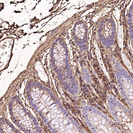Immunohistochemical analysis of paraffin-embedded Human colon, using the Antibody at 1:100 dilution