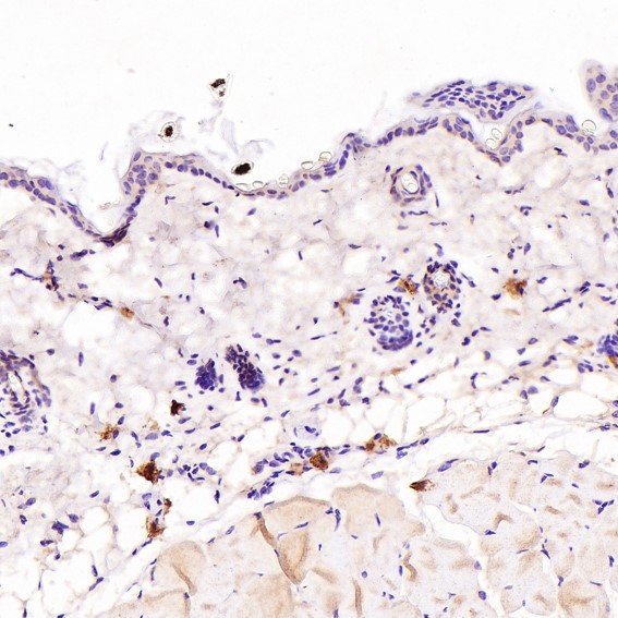Immunohistochemical analysis of paraffin-embedded Mouse skin, using the Antibody at 1:100 dilution