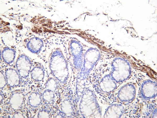 m04578 2 cald1 primary antibodies ihc testing 1