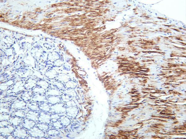 m04578 2 cald1 primary antibodies ihc testing 2
